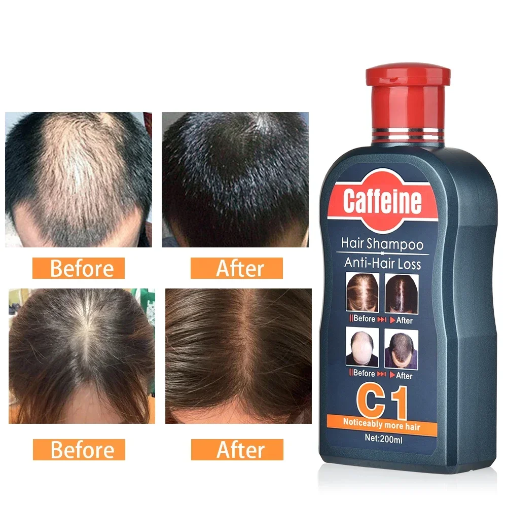 Szampon dla mężczyzn na porost – Hair Care Korean Products recenzja i cena